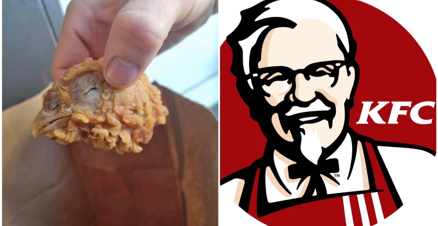 Customer served with full chicken head with eyes & beak in KFC hot wings box